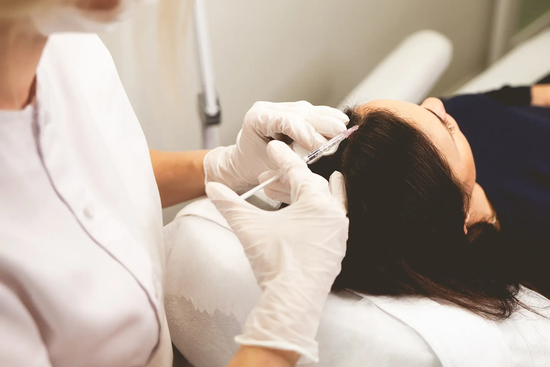 Understanding PRP Therapy for Hair Loss