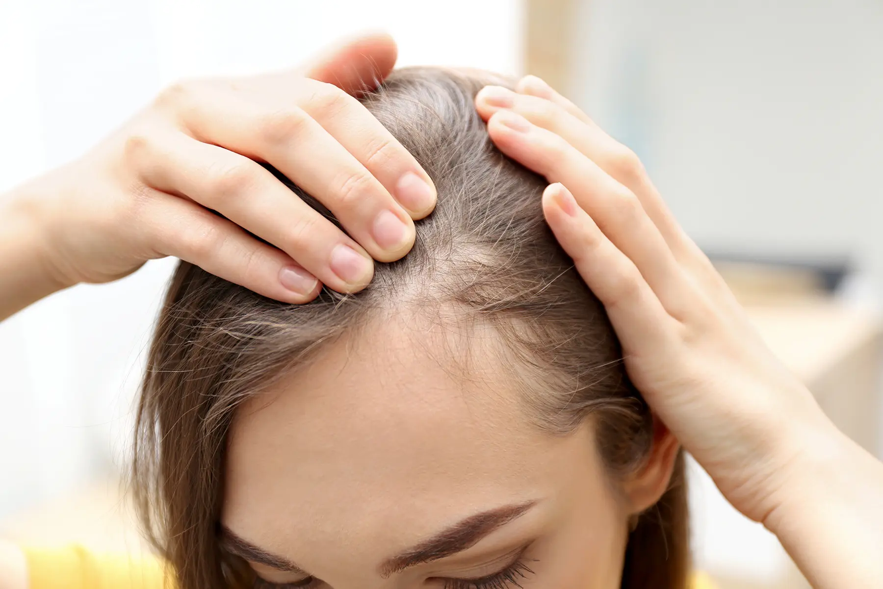 Hormonal Reasons for Hair Loss: How to Support Regrowth