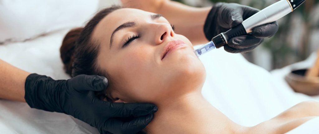 Microneedling