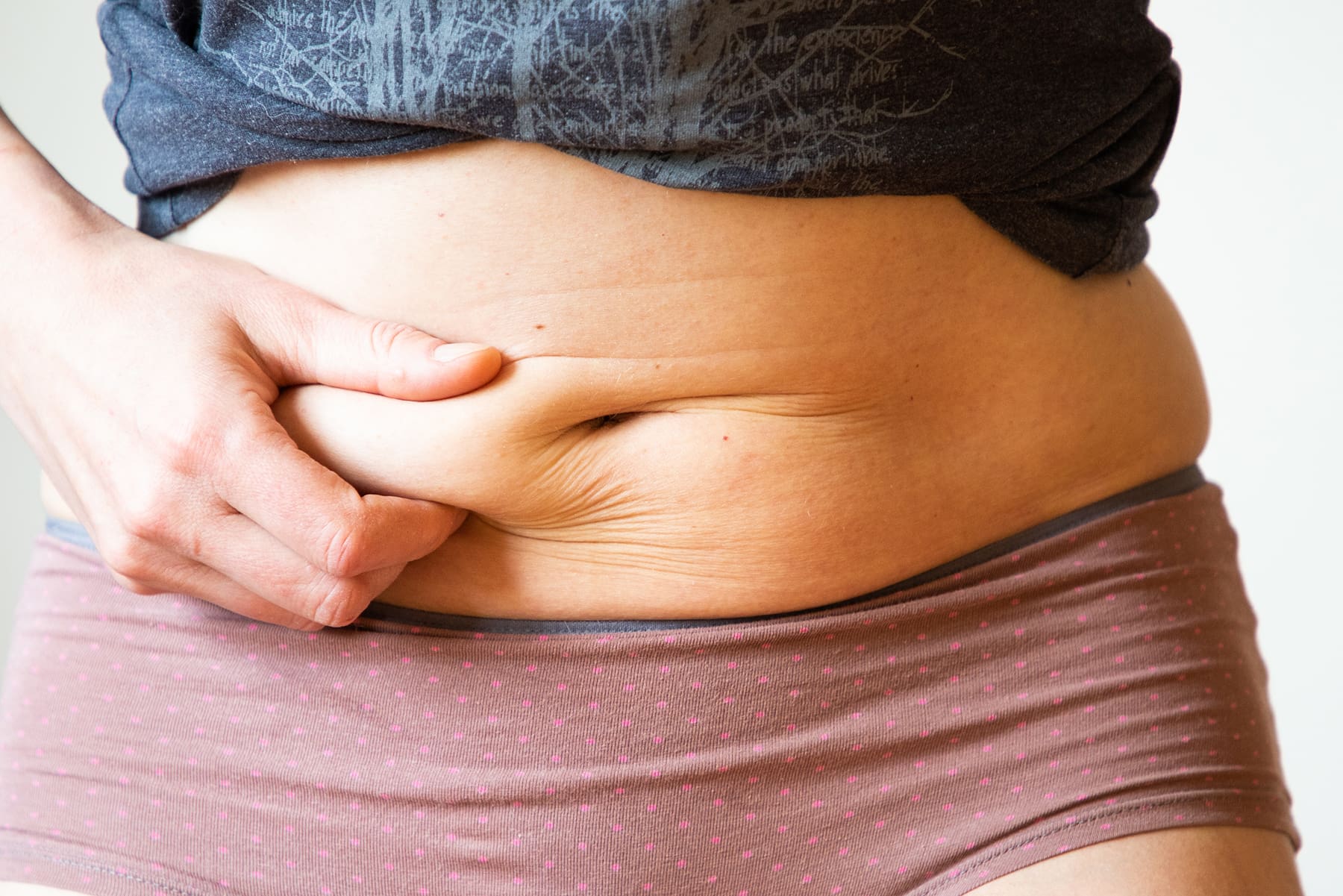 How to Prevent Loose Skin During Weight Loss
