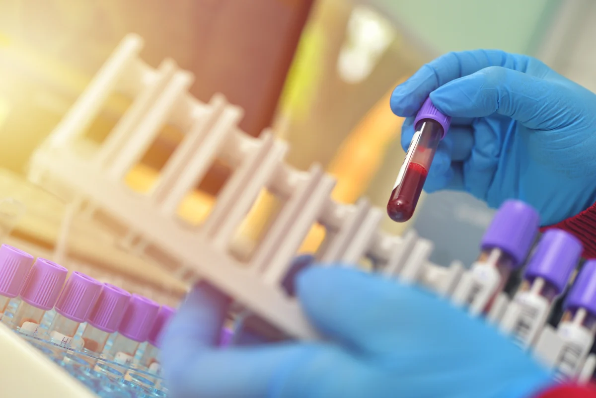 Blood sample tubes representing the comprehensive bloodwork behind care at Pure Body Health in South Tempe, AZ