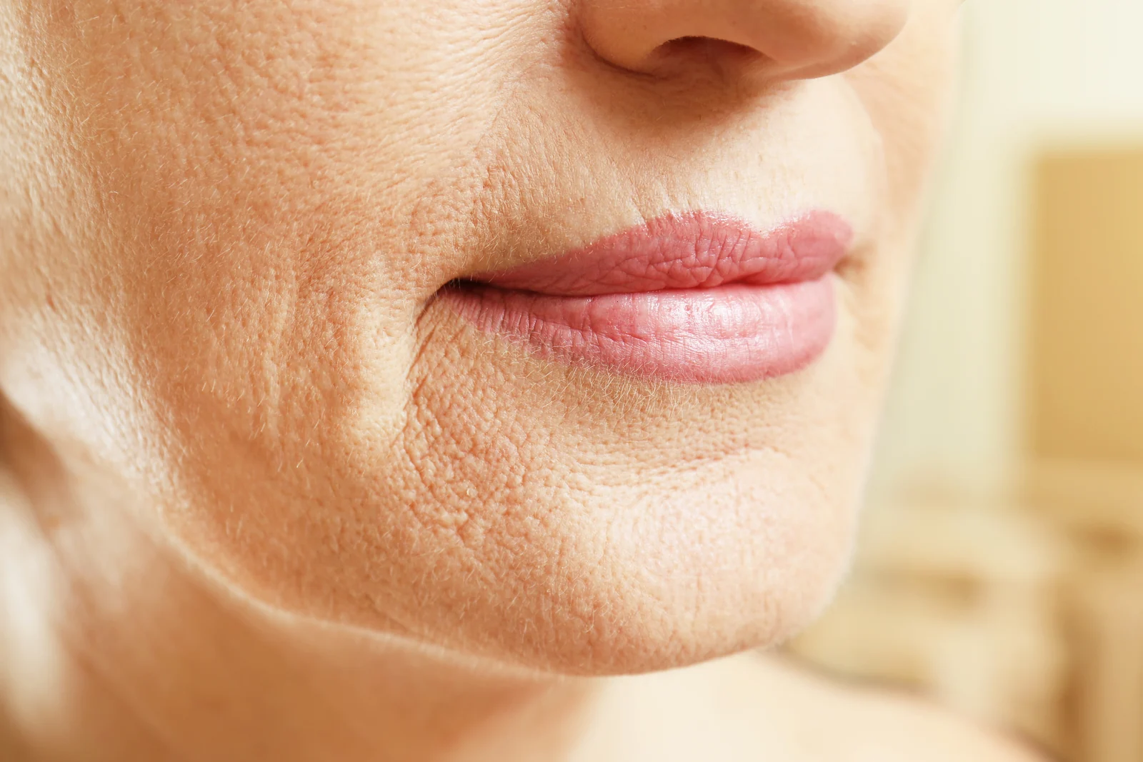 Close up of a mature woman's lower face showing smile lines and fine wrinkles around the mouth, explained by Pure Body Health in South Tempe, AZ.