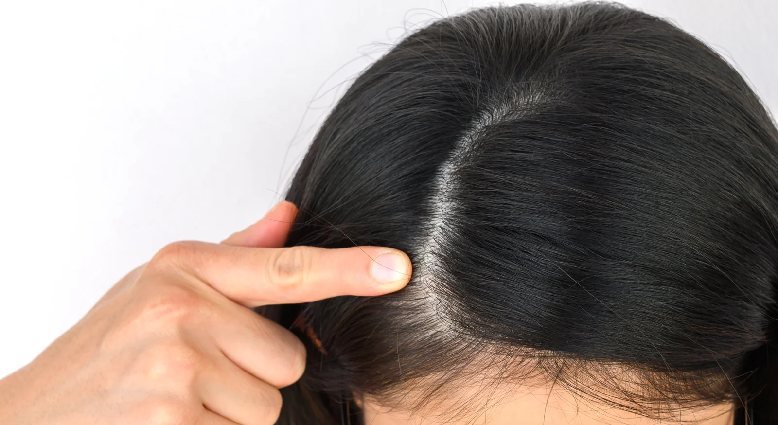 Woman pointing to a widening part in her dark hair, an early sign of hormonal hair thinning that brings many women in South Tempe, AZ, in for labs.