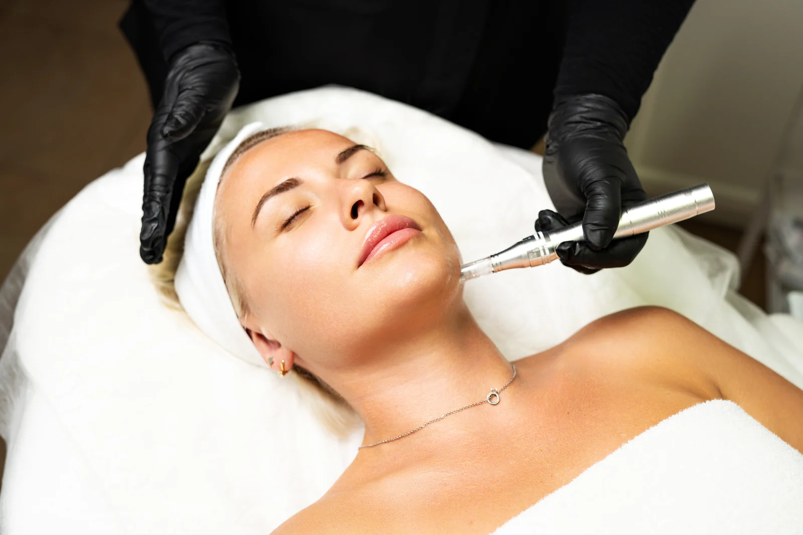 Relaxed patient with eyes closed as a gloved clinician moves an RF microneedling handpiece along her jaw in South Tempe, AZ.